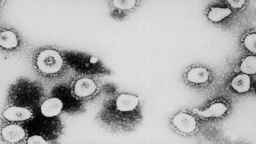 العلماء يسجلون خلايا فيروس "تطوف" بحثا عن طريق للانتشار والعدوى!