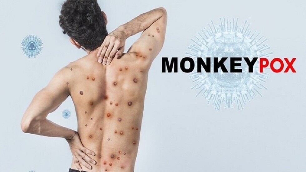 سعي دولي وأمريكي إلى إبعاد "القردة" عن الجدري!