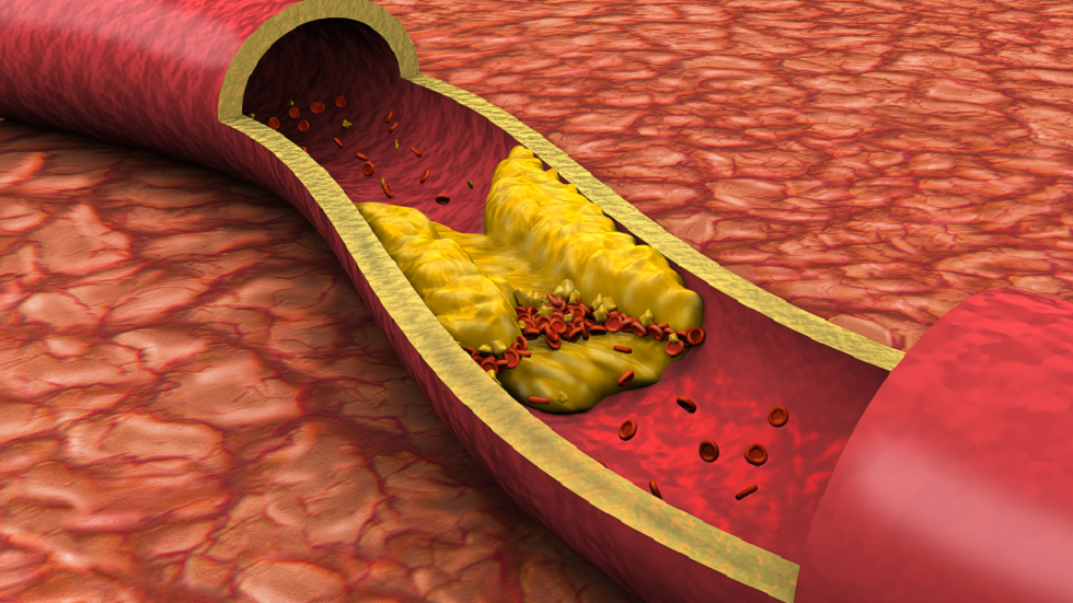 أطعمة ومشروبات مليئة بالفلافونويد "ثبت أنها تقلل الكوليسترول"!