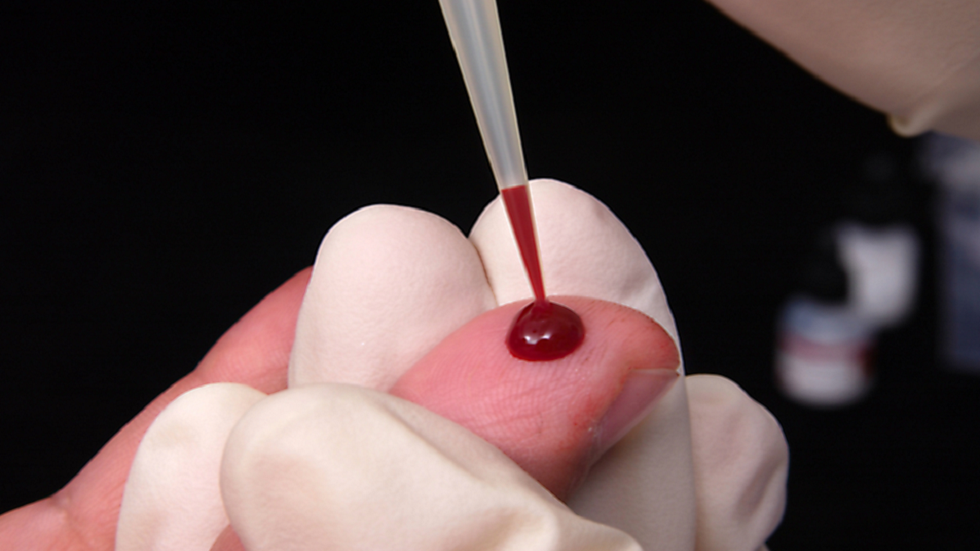 اختبار دم يمكن أن يكشف أنواعا متعددة من السرطان في وقت مبكر!