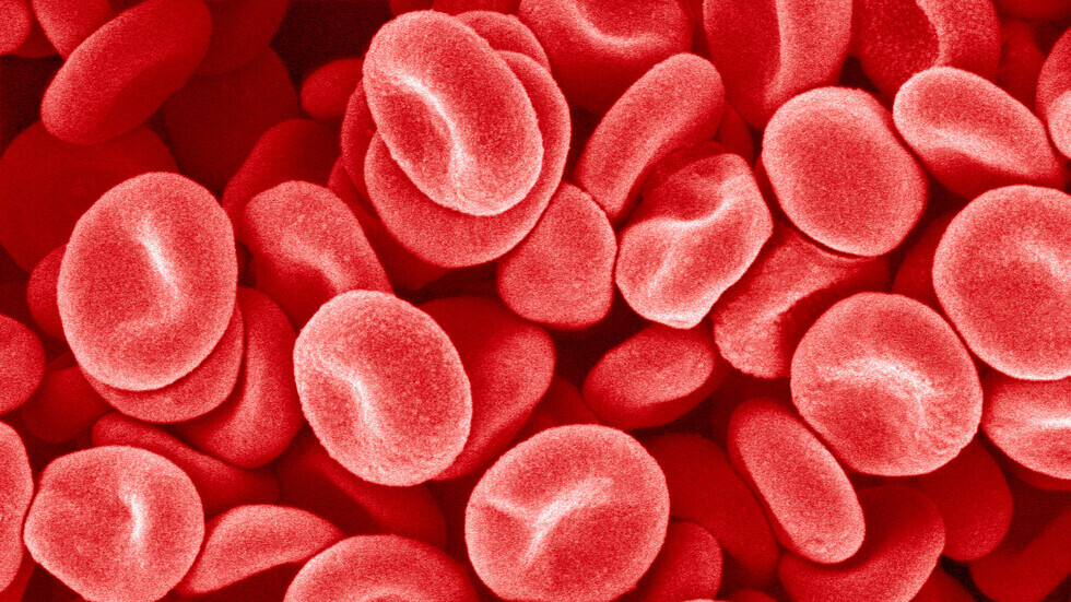 دراسة تكشف فصيلة الدم التي تتنبأ بخطر الإصابة بمرض فيروسي يصيب الأطفال