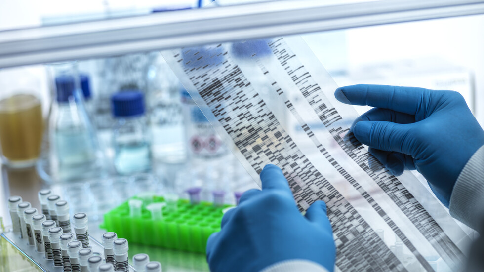 فقدان كروموسوم Y قد يرتبط بزيادة خطر إصابة الرجال بـ