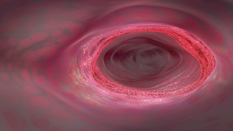 صبغة طعام شعبية يمكن أن تسبب مرض التهاب الأمعاء!