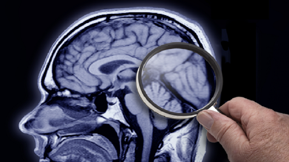 المخاوف تتزايد بشأن عقار واعد لمرض ألزهايمر مع موت مريض ثالث في تجربة كبيرة!