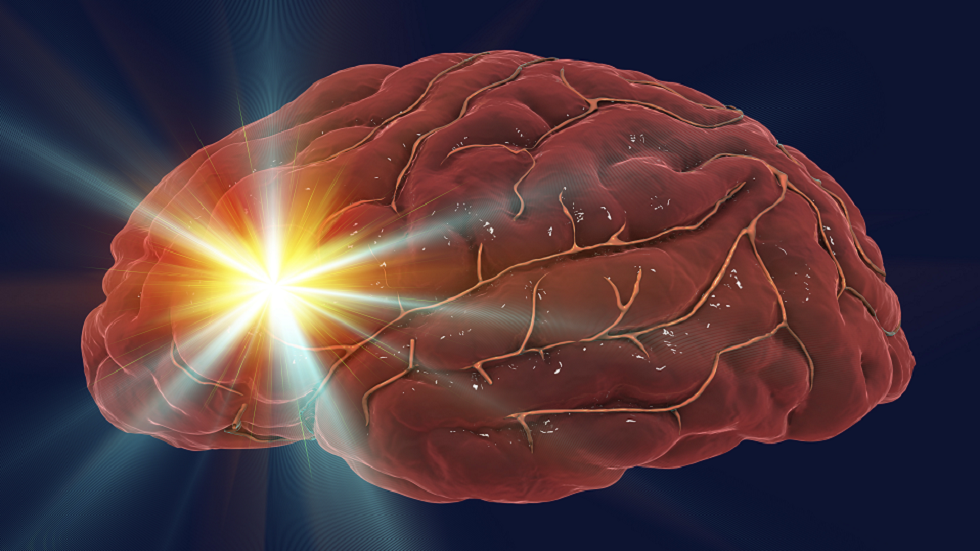 تجارب تكشف عن تقنية ذكية ترفع نسبة تعافي ضحايا السكتة الدماغية!