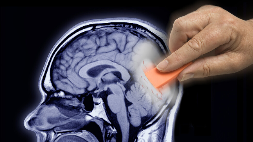 الولايات المتحدة تجيز دواءً جديدا لعلاج مرضى ألزهايمر