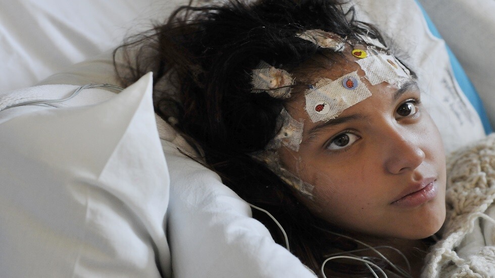 كشف سبب الصرع الغامض عند الأطفال