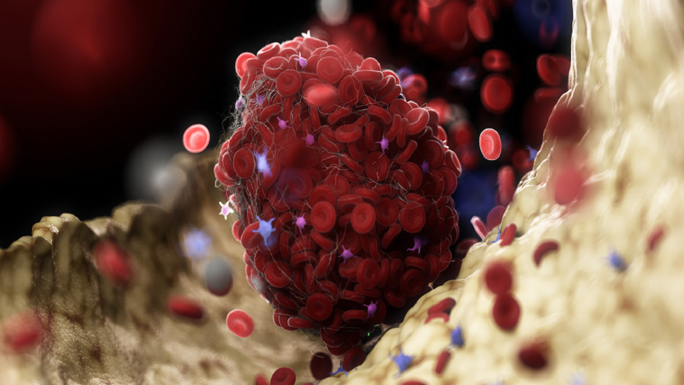 خبيرة توصي بمكملات غذائية "قوية" لمنع تجلط الدم مع بلوغنا منتصف العمر!