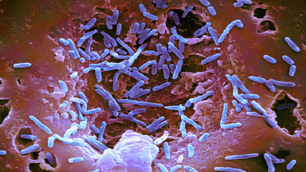 باحثون: التعرض للسالمونيلا "عامل خطر قد يمهد للإصابة بسرطان الأمعاء ونمو الأورام"