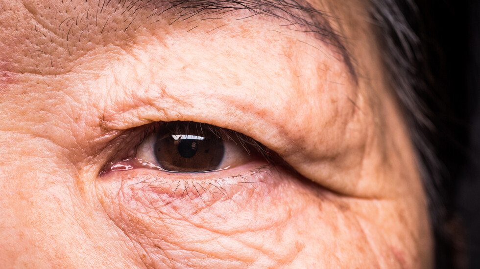 لماذا يتسبب الالتهاب في شيخوخة الجسم المبكرة؟