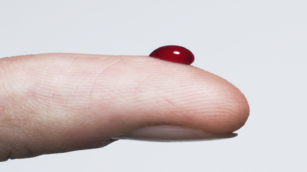 كيف يمكن أن يؤدي ارتفاع مستويات السكر في الدم إلى نزيف اللثة؟