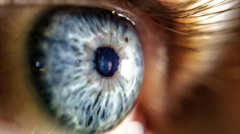 الأطعمة المضادة للالتهابات 