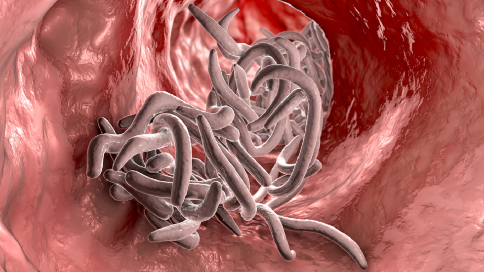 دراسة "مفاجئة": الأطعمة الدهنية يمكن أن تساعدك على التخلص من الطفيليات المعوية القاتلة!