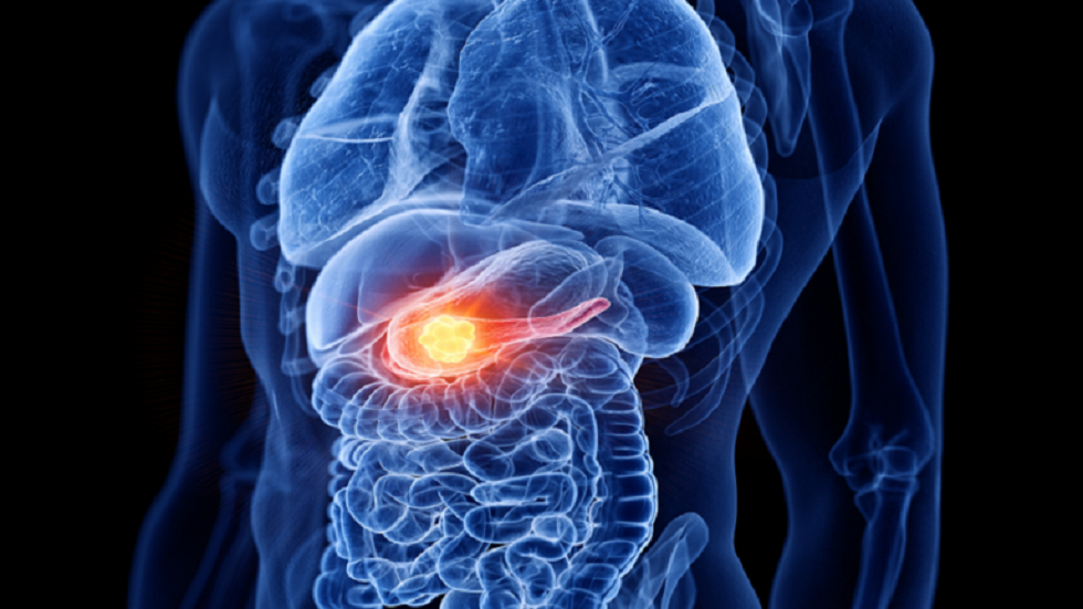 طبيب روسي يوضح سبب الخلط بين احتشاء عضلة القلب والتهاب البنكرياس