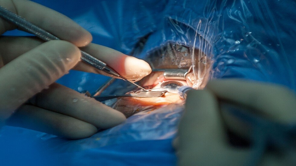 طبيب عيون يوضح كيفية التعرف على إعتام عدسة العين مبكرا