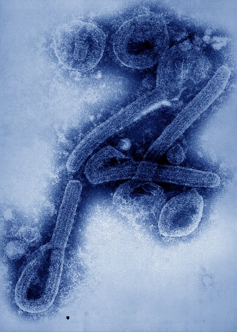 تأكيد وفاة 5 أشخاص بسبب مرض ماربورغ في دولة إفريقية