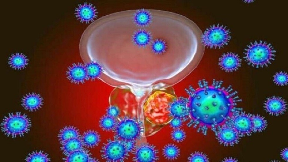 "علاج إشعاعي" لمدة 5 أيام يمكن أن "يعالج'' سرطانات البروستات العالية الخطورة أسرع من المعتاد!