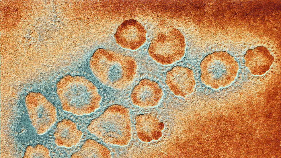 إصابة رجل بإنفلونزا الطيور تثير مخاوف العلماء بعد اكتشاف 