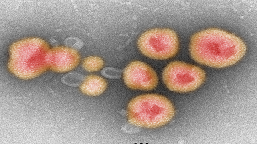 اكتشاف 30000 فيروس جديد مختبئ في الحمض النووي للميكروبات!