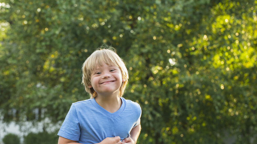 باحثون يحددون الأساس الجيني لتغيرات الوجه في متلازمة داون