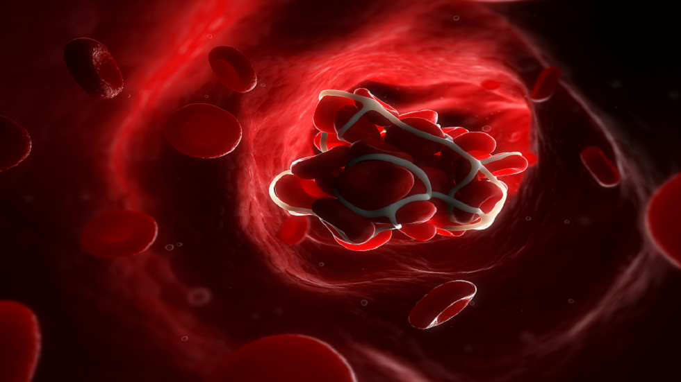 "نظام اصطناعي جديد" يمكن أن يساعد في وقف النزيف الداخلي!