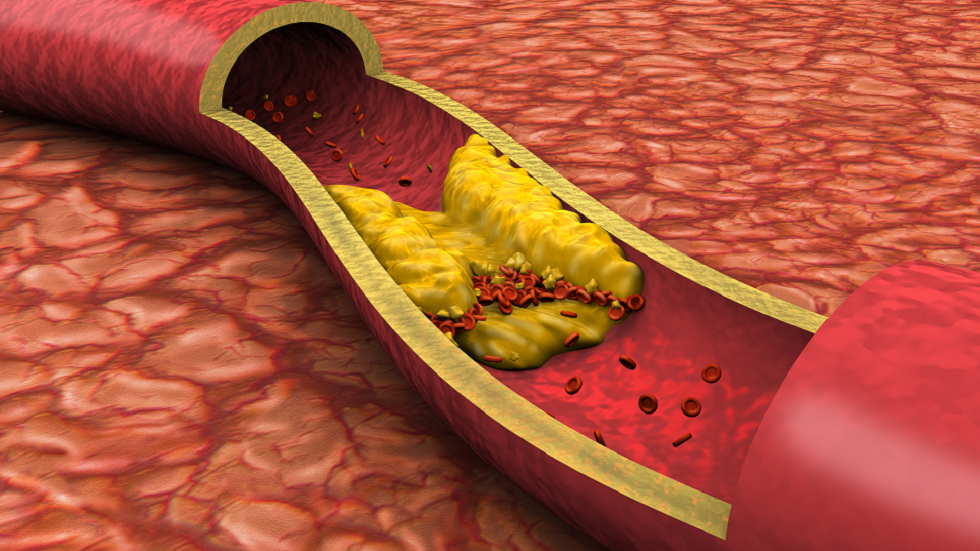 7 أطعمة يمكن أن تساعد في خفض الكوليسترول!