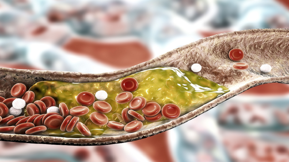 أربعة أطعمة يجب إضافتها إلى وجبة الإفطار للمساعدة في خفض نسبة الكوليسترول