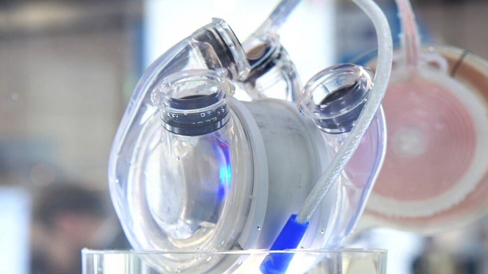 الأولى في الكويت والثانية عربيا.. نجاح أول زراعة مضخة قلب اصطناعي