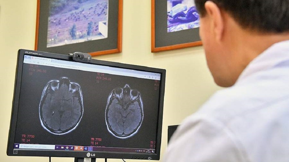 أخصائي أورام يوضح طرق الوقاية من أورام الدماغ