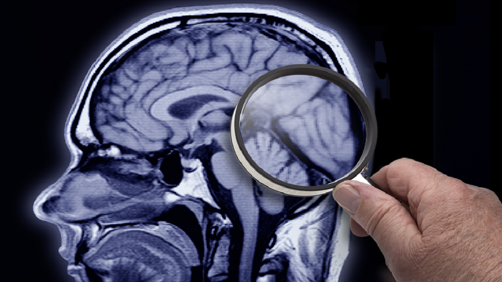 دراسة جديدة تربط بين تغير المناخ وتقلص حجم الدماغ لدى البشر!