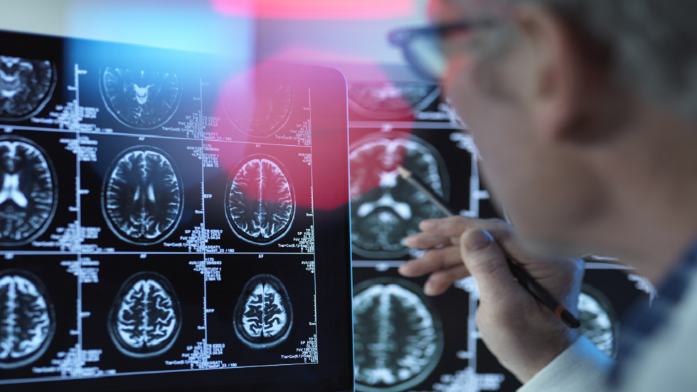 إدارة FDA الأمريكية تتيح الوصول إلى عقار جديد واعد لمرض ألزهايمر!