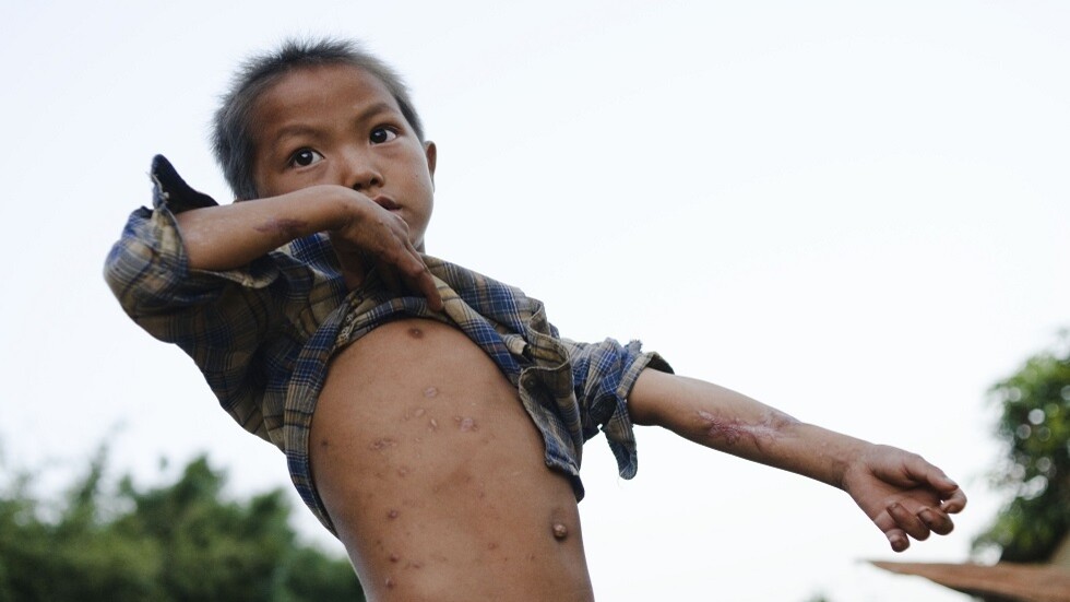 نواب الكونغرس يستذكرون "إرث بلادهم السيء" مع استخدام جيشهم للقنابل العنقودية في جنوب شرق آسيا