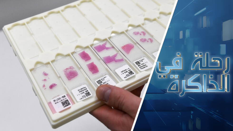 تشخيص "الخلية المتمردة".. كيف نجعل خطر تطور السرطان في الحد الأدنى؟