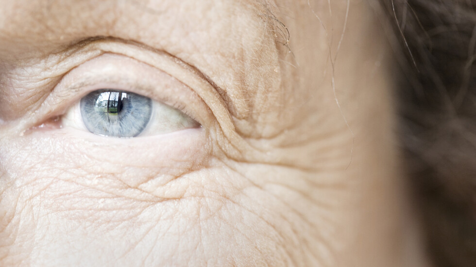 صورة صادمة تكشف عما يمكن أن تسببه 28 سنة من أضرار أشعة الشمس على الوجه