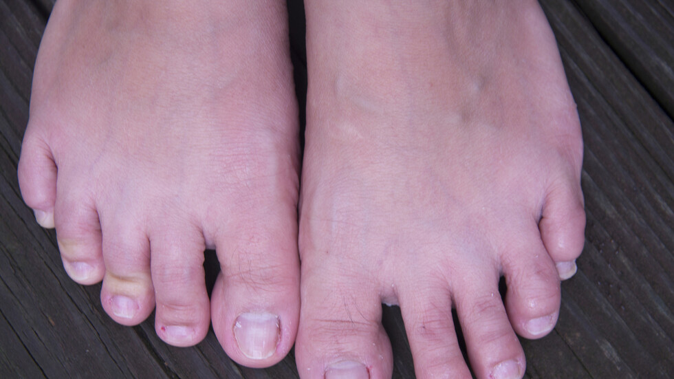 علماء يحددون عارضا غريبا وجديدا لـ