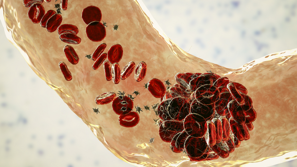 مشروبات غير كحولية يمكن أن تزيد من خطر تجلط الدم خلال 