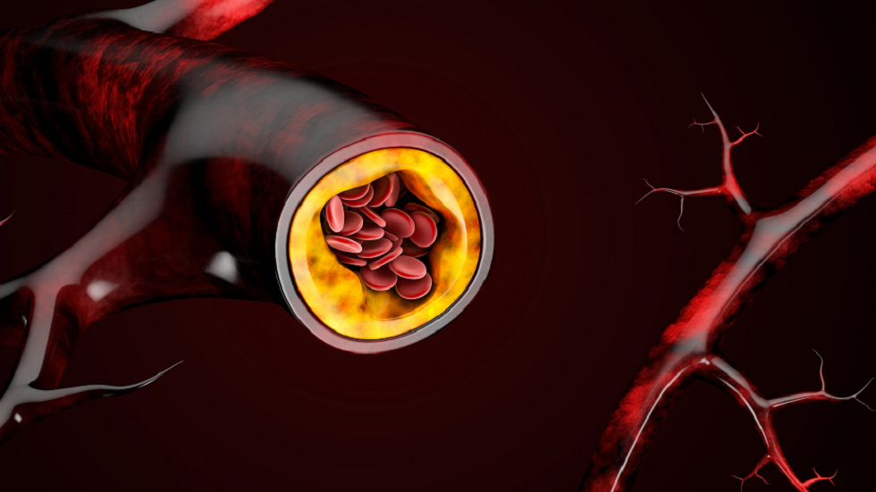 3 علامات تحذيرية يمكن أن تكون العارض 