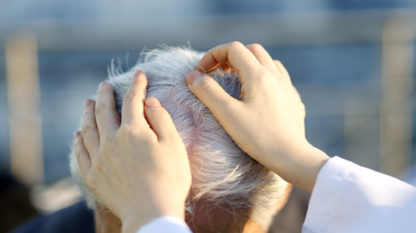 8 علامات تحذيرية غير معروفة على فروة الرأس من مرض مميت!