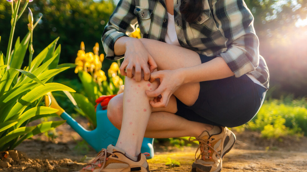 4 إسعافات منزلية تساعد على إيقاف الحكة المزعجة للدغات الحشرات