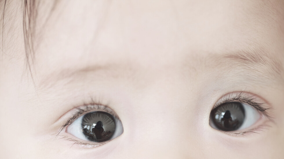 عيون رضيع تتحول من اللون البني الداكن إلى الأزرق بعد تلقيه دواء معتمدا لعلاج 