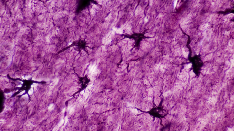 اكتشاف خلايا دماغية 