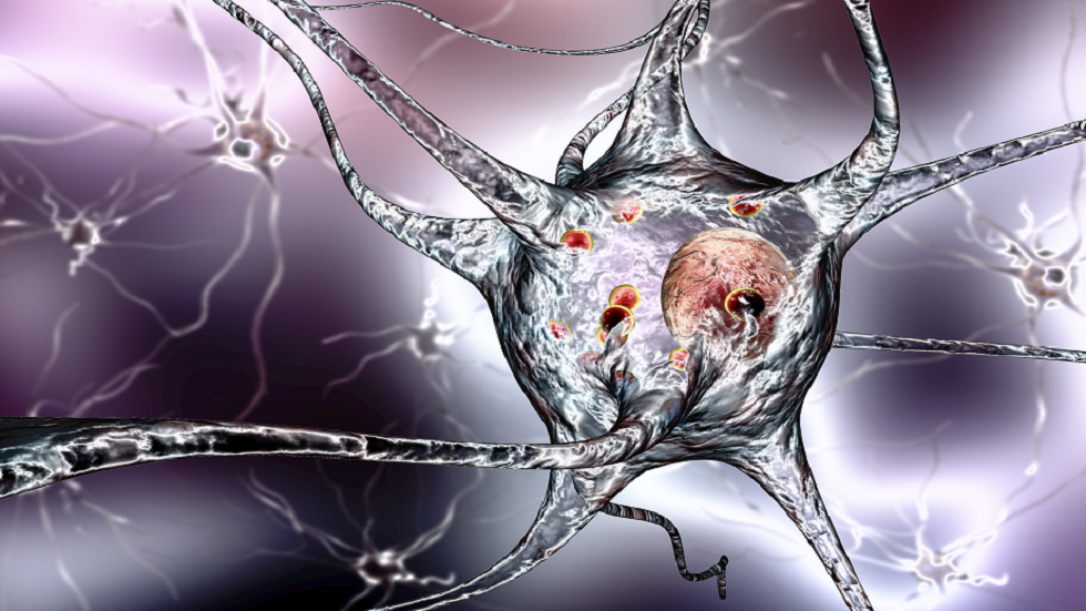 "اكتشاف هام" يحمي من ألزهايمر وباركنسون معا!