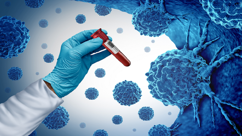 لأول مرة في دراسة ضخمة.. اكتشاف 11 جينا عدوانيا لسرطان البروستات!