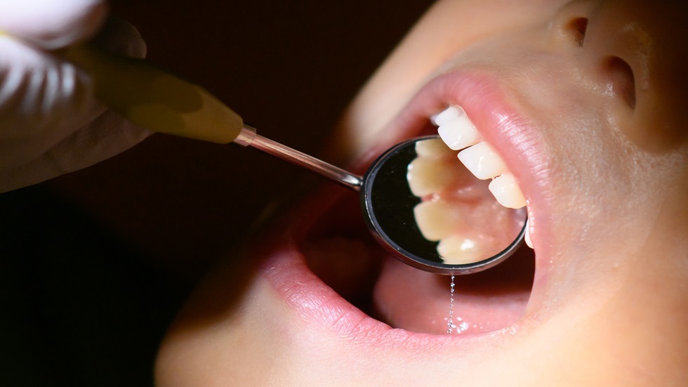 طبيبة تحدد العادات السيئة المدمرة للأسنان
