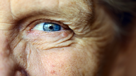 حالة شائعة في العين تهدد كبار السن بالعمى دون أن يدركوا ذلك