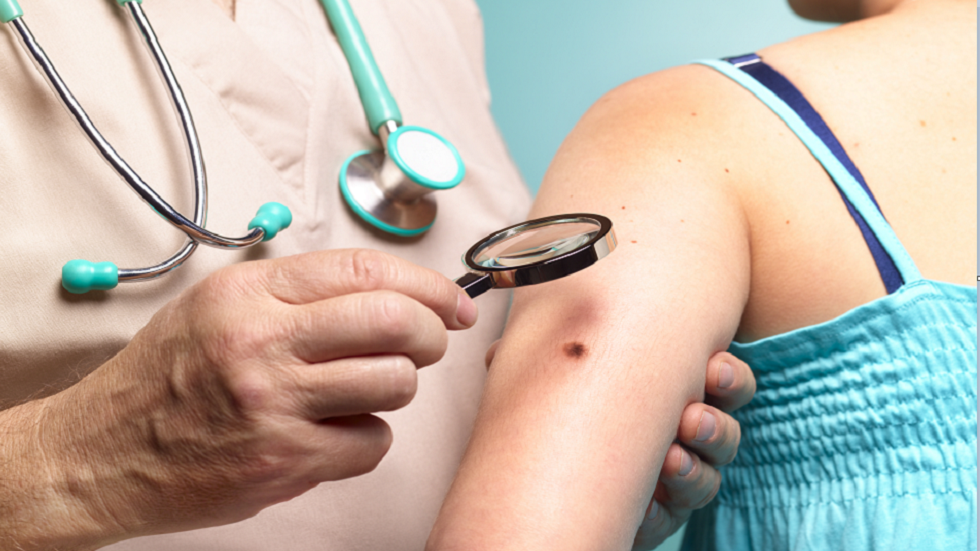 "اكتشاف مفاجئ" حول أخطر أشكال سرطان الجلد!