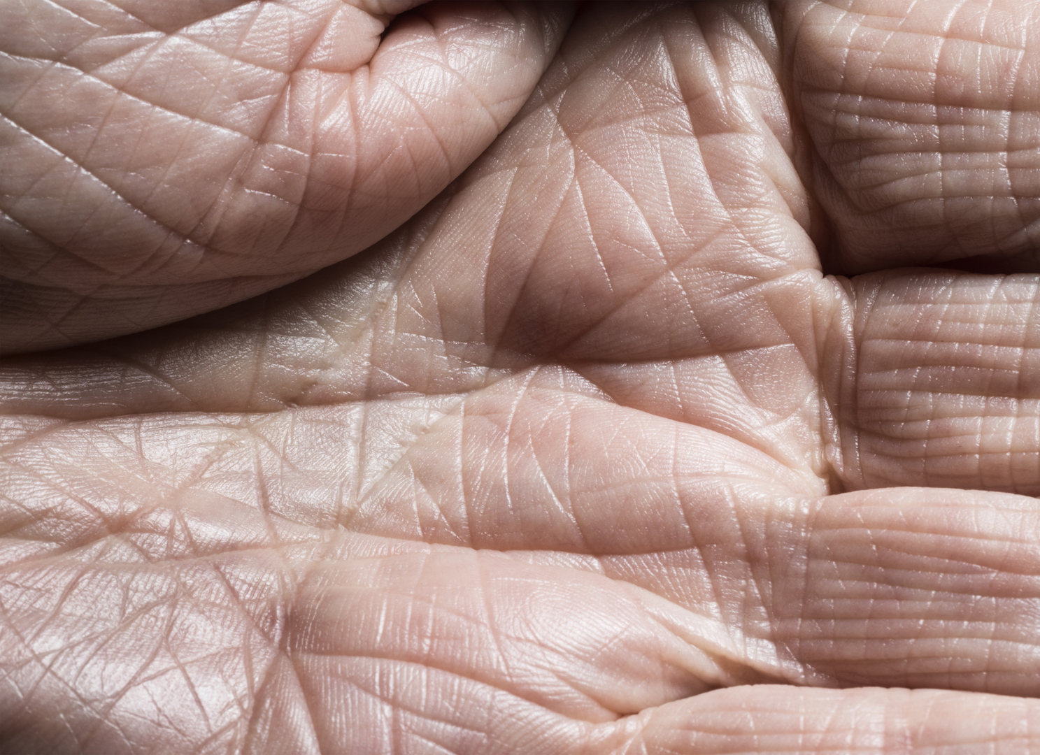 العلماء يطورون جلدا شبيها بالجلد البشري أكثر من أي وقت مضى