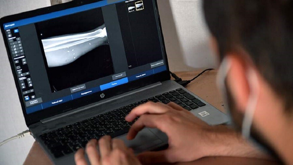 روسيا.. ابتكار سيراميك حيوي فريد لترميم العظام