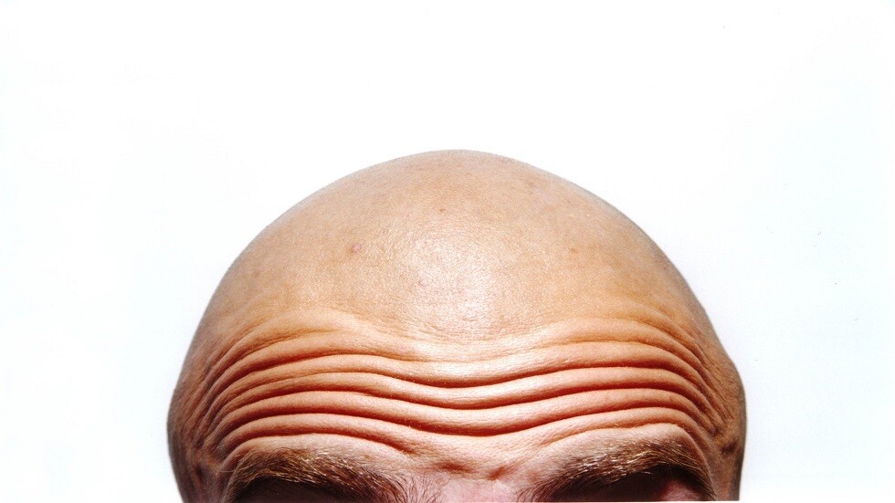 "علامات خارجية" تشير إلى أمراض القلب