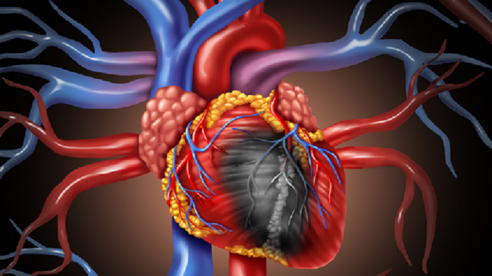 الكشف عن عامل مهمل يزيد من خطر الإصابة باحتشاء عضلة القلب